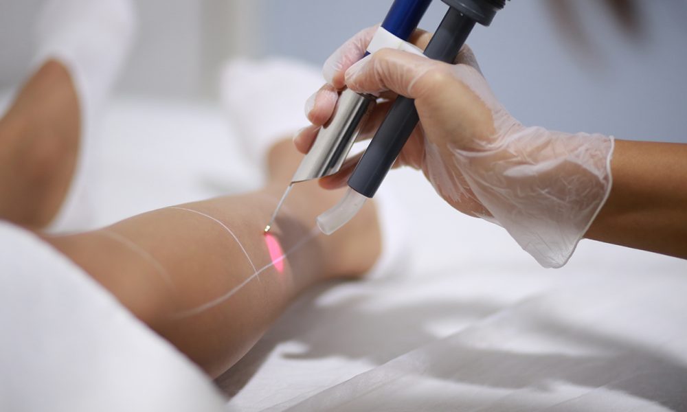 Isparta Lazer Epilasyon