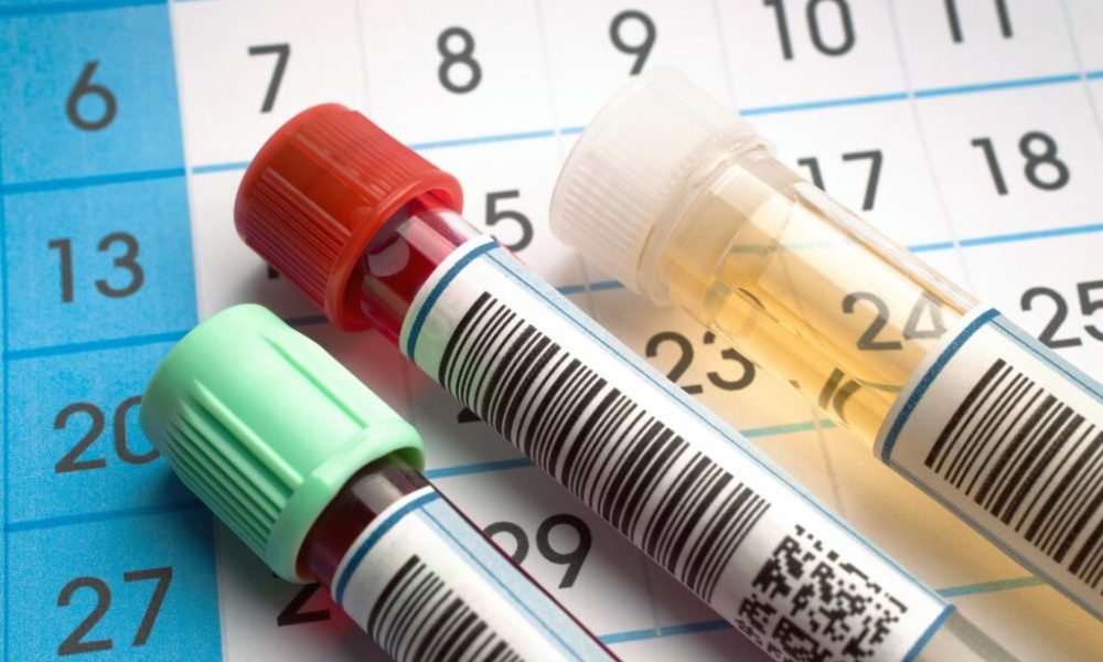 Böbrekleriniz Gerçekten Sağlıklı mı?