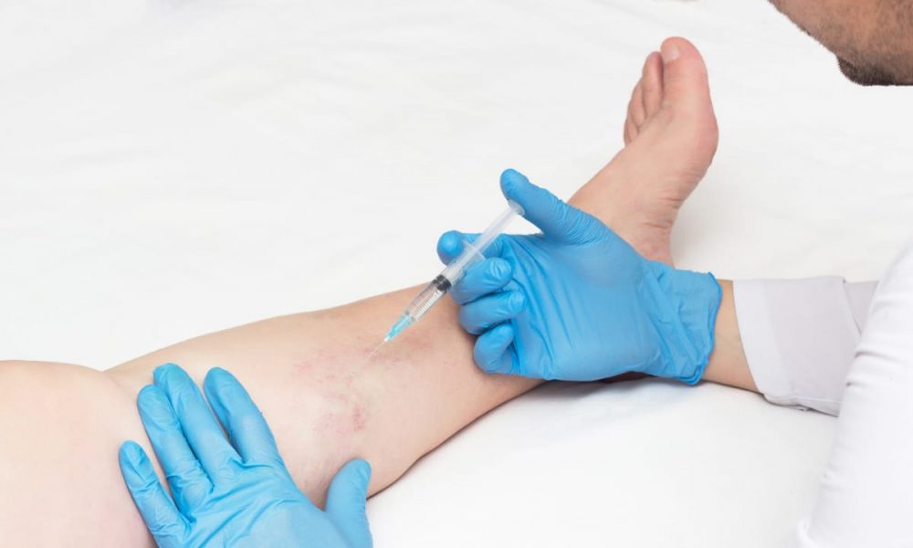 Varis Hastalığında Genetik Özellikler Riski Artırıyor