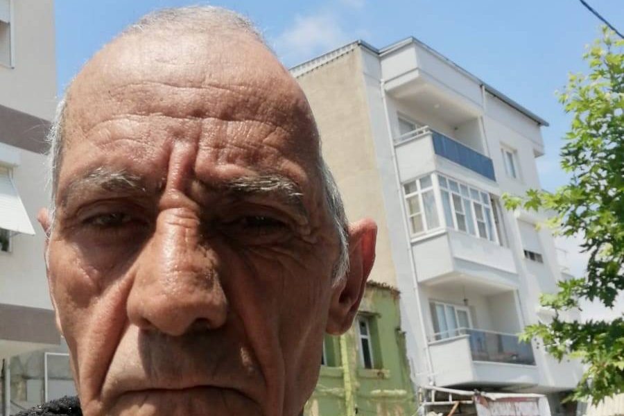 Kafatasının Üçte Biri Yok ! 