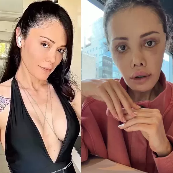 Didem Ceran Kore’de Yüz Nakli Geçirdi